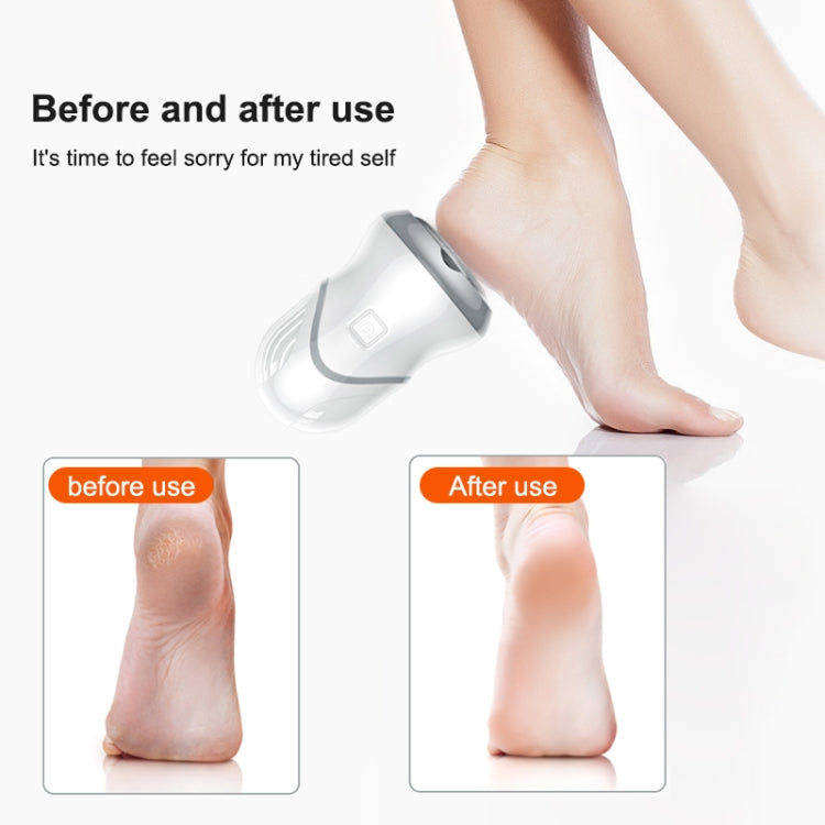 Electric Vacuum Design Foot Grinder Household Multifunctional Pedicure Calluses Foot Care My Store