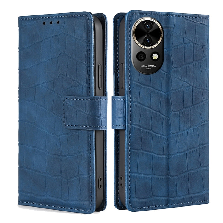 Skin Feel Crocodile Magnetic Clasp Leather Phone Case, Series 1