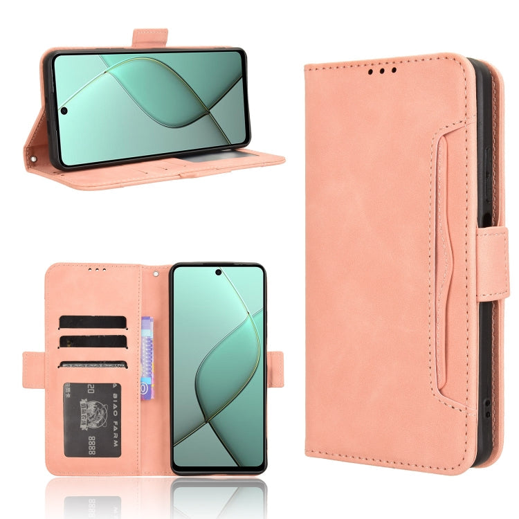 Skin Feel Calf Texture Card Slots Leather Phone Case, Series 1 My Store