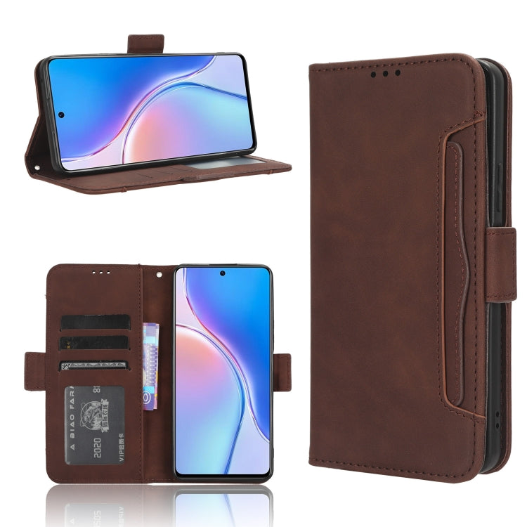 Skin Feel Calf Texture Card Slots Leather Phone Case, Series 1 My Store