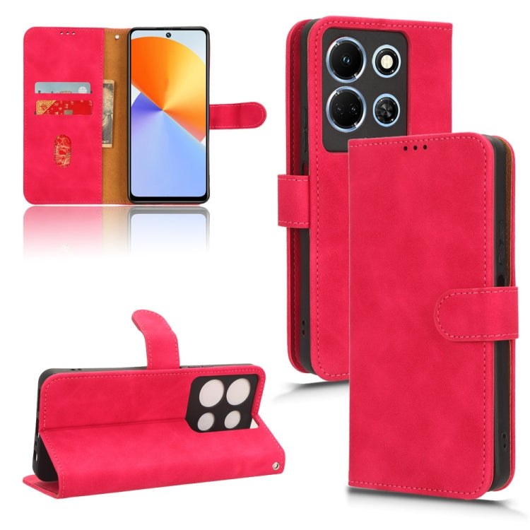 Skin Feel Magnetic Flip Leather Phone Case, Series 1 My Store