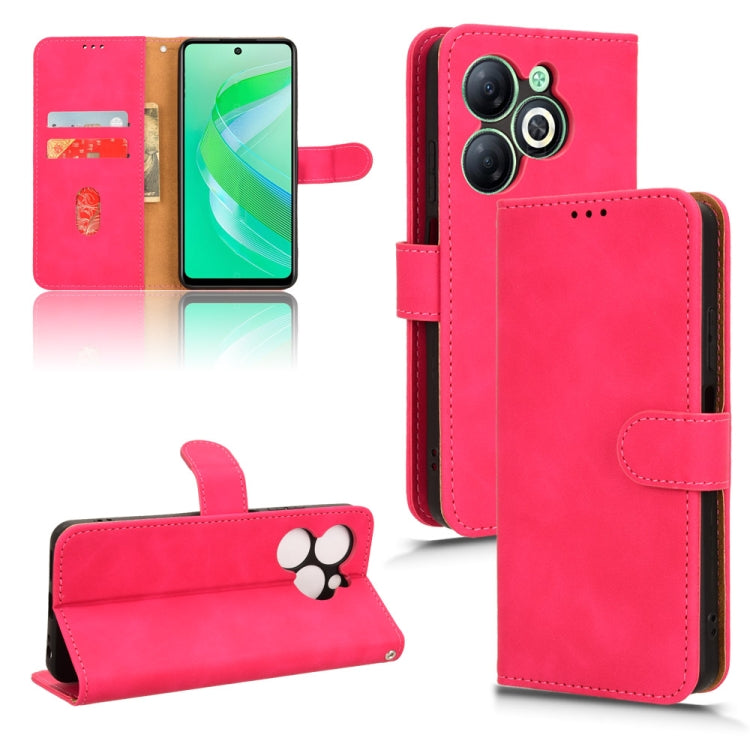 Skin Feel Magnetic Flip Leather Phone Case, Series 1 My Store