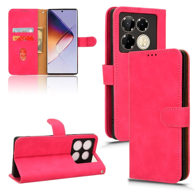 Skin Feel Magnetic Flip Leather Phone Case, Series 3 My Store