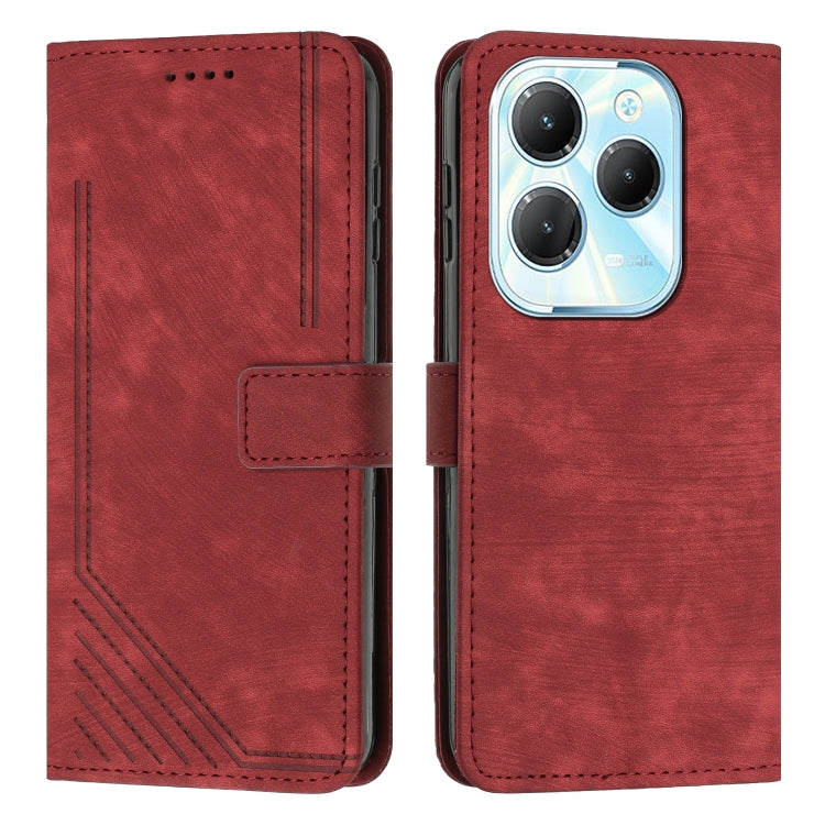 Skin Feel Stripe Pattern Leather Phone Case with Lanyard, Series 3 My Store