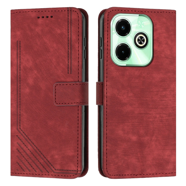 Skin Feel Stripe Pattern Leather Phone Case with Lanyard, Series 3 My Store