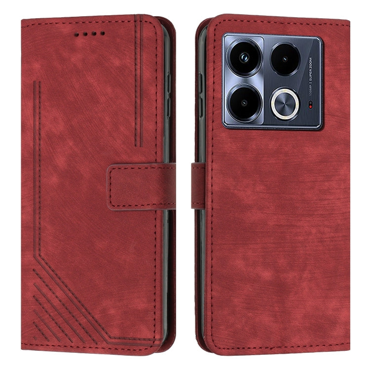 Skin Feel Stripe Pattern Leather Phone Case with Lanyard, Series 2 My Store