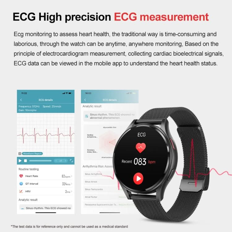 1.43 inch Milanese Steel Strap Bluetooth Call Smart Watch Support ECG / Non-invasive Blood Sugar