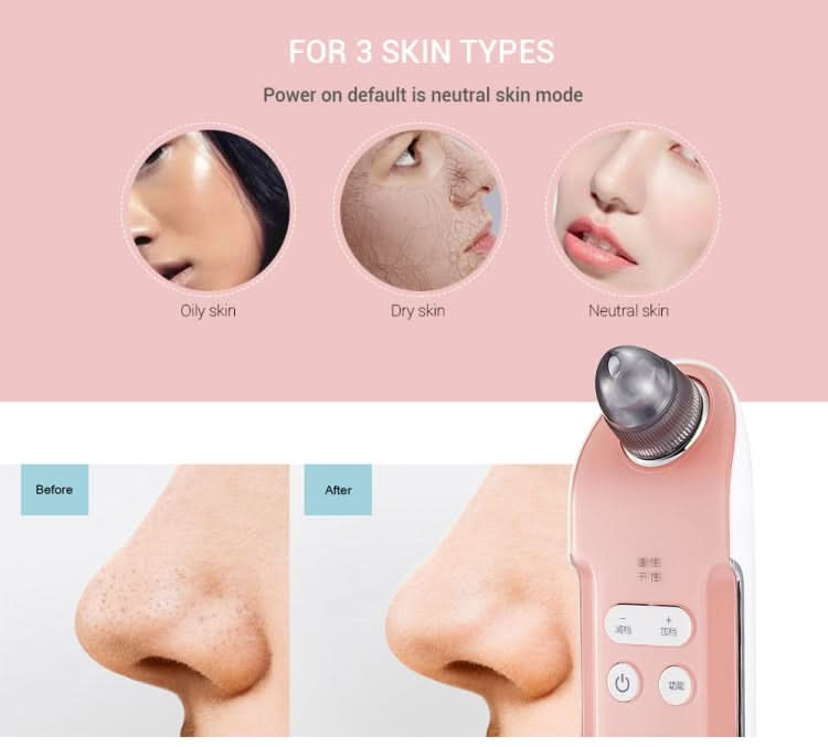 K-SKIN 3 Level Intensity Blackhead Removal Pore Cleaner Suction Rechargeable Black Spot Cleaner Facial Cleaning Machine Reluova