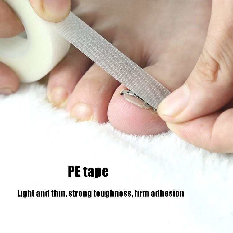 Orthopedic Buckle Toe Nail Groove Ingrown Nail Corrector Reluova