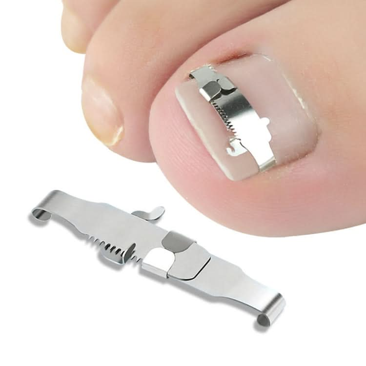 Orthopedic Buckle Toe Nail Groove Ingrown Nail Corrector Reluova