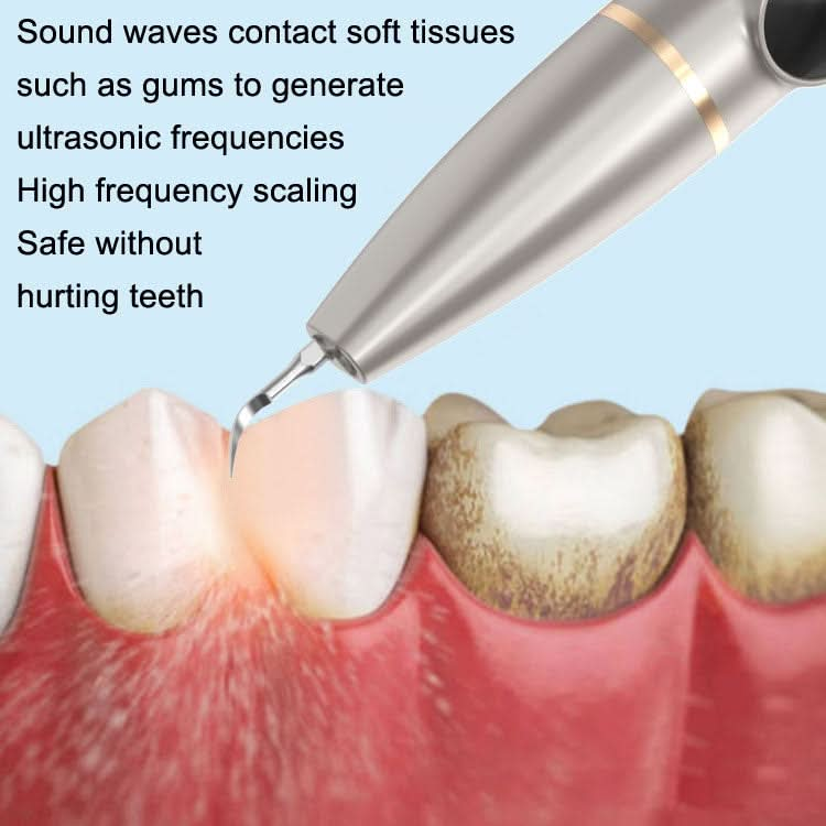 Tartar and Calculus Remover Oral Cleaning Ultrasonic Scaler Electric Visual Scaler Reluova