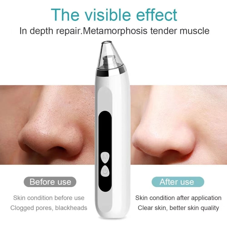 Blackhead Remover Vacuum Pore Cleaner Facial Deep Cleaning Beauty Tools Reluova