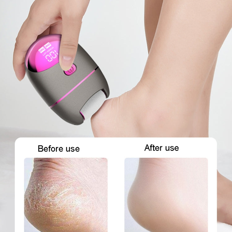 Women Electric Pedicure Callus Removal Pedicure Machine Exfoliation Tool Electric Pedicure