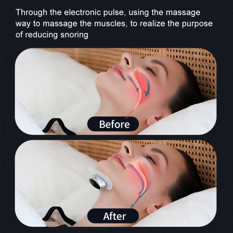 Smart Anti-snoring Device TENS Double Pulse Sound Wave Induction Sleep Snoring Breathing Corrector My Store