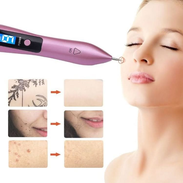 9 Gears Mole Spotting Pen LCD Home Laser Mole Spot Sweeping Beauty Instrument My Store