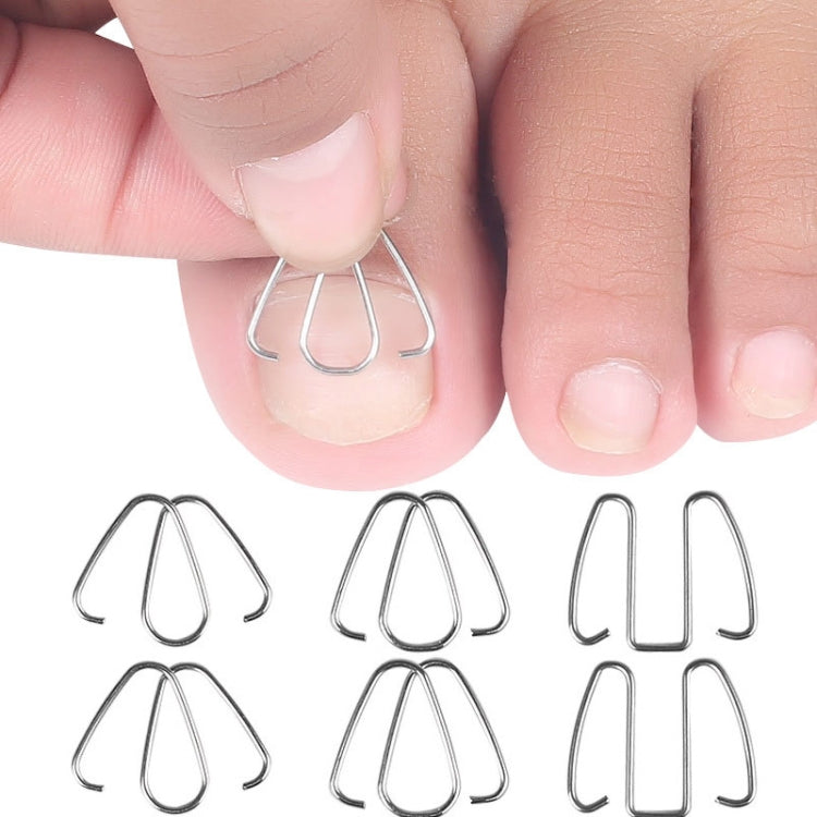 6pcs /Box Ortho Wire Nail Insertion Orthotic Toe Nail Ortho Hooks(Original Color)-Reluova