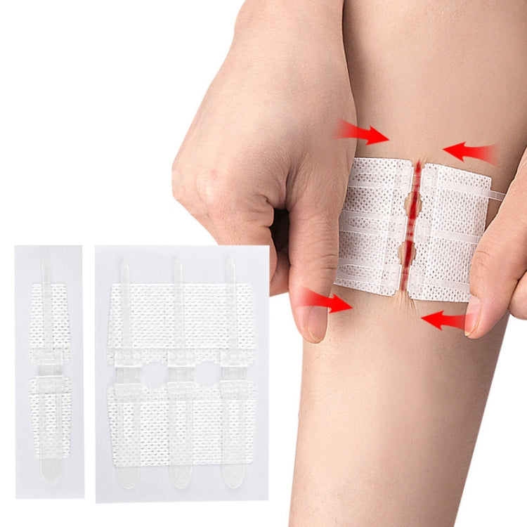 Non-woven Elastic Bandage Wound Patch Two Way Zipper Type Locking Closure Self-Adhesive Bandage Patch My Store